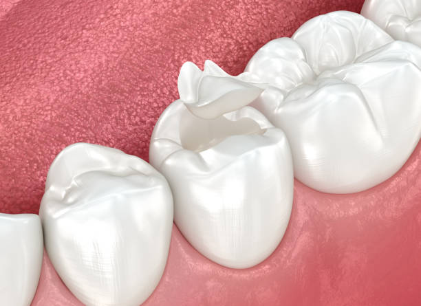 Best Dental Exams and Cleanings  in Traer, IA